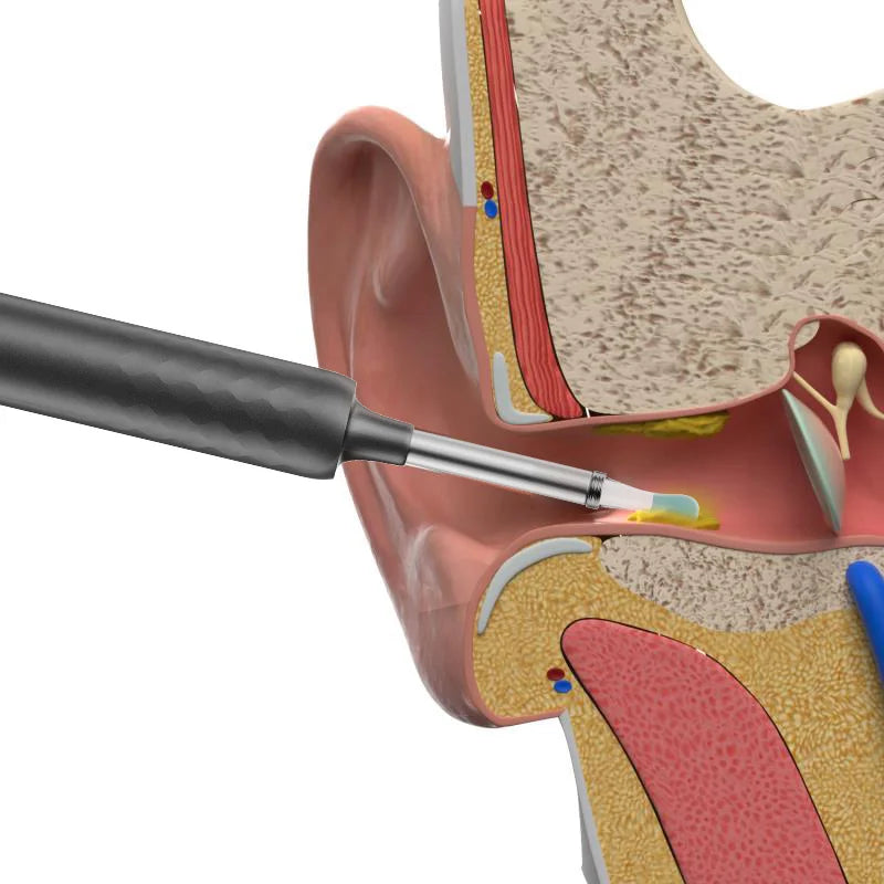 Bebird R1/X3/R3 Otoscópio Auricular Smart com Câmera HD 300MP – Endoscópio de Alta Precisão com Wi-Fi | Limpador de Ouvido Inteligente