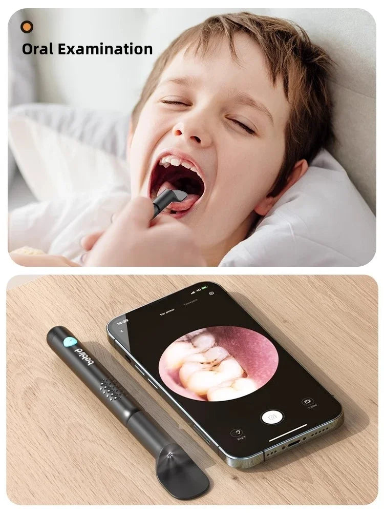 Bebird R1/X3/R3 Otoscópio Auricular Smart com Câmera HD 300MP – Endoscópio de Alta Precisão com Wi-Fi | Limpador de Ouvido Inteligente