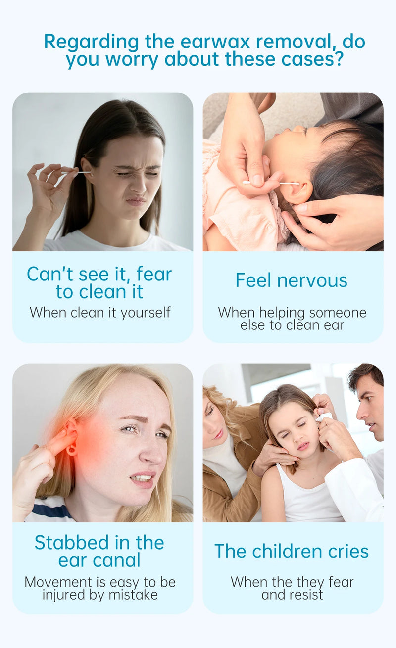 Bebird R1/X3/R3 Otoscópio Auricular Smart com Câmera HD 300MP – Endoscópio de Alta Precisão com Wi-Fi | Limpador de Ouvido Inteligente