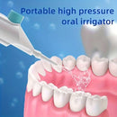 Irrigador Oral de Alta Pressão Portátil – Limpeza Profunda para Seus Dentes!