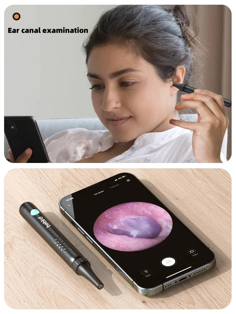 Bebird R1/X3/R3 Otoscópio Auricular Smart com Câmera HD 300MP – Endoscópio de Alta Precisão com Wi-Fi | Limpador de Ouvido Inteligente